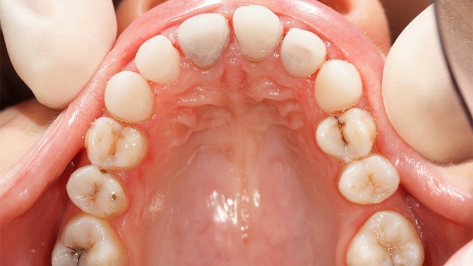 icon-tooth8