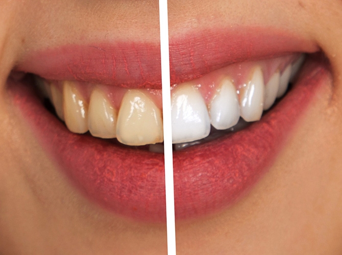 icon-dentist6
